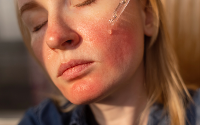 Why 3.5% Niacinamide Is the Best Concentration for Your Skin — The Science Behind The Daily Reset